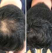 Health & Aesthetics Permanent Make Up/ Haarpigmentierung und Zahnbleaching - GALLERY