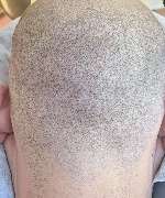 Health & Aesthetics Permanent Make Up/ Haarpigmentierung und Zahnbleaching - GALLERY