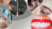 Health & Aesthetics Permanent Make Up/ Haarpigmentierung und Zahnbleaching - GALLERY