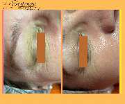 Institut für Kosmetik und Face-Design Margrit Fürstenau - DFDBE768-51B2-4720-95E3-CF38C80B3B8B.png