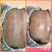 Institut für Kosmetik und Face-Design Margrit Fürstenau - incollage_save.jpeg