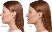 Kathleen Priester – Praxis für Ästhetische Medizin & Longevity Karlsruhe - GALLERY