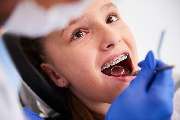 Kieferorthopäde Weißenhorn, Dr. Reichwein-Kalke | schnelle Termine, auch ohne Überweisung - GALLERY