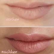 Lippen vergrössern ohne Spritzen