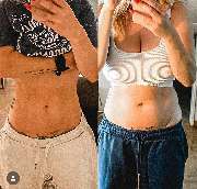 Kryolipolyse Beauty Queen Josys cosmetica - GALLERY