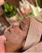 Kryolipolyse Beauty Queen Josys cosmetica - GALLERY