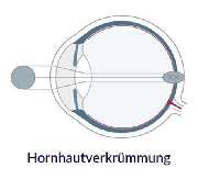 lasik germany - Standort Hamburg - GALLERY