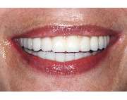 Löffler Thomas Dr.med.dent. - GALLERY