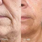 Medichelle Cosmetics - Sara_pavo_cosmetics-essen-kosmetik.png