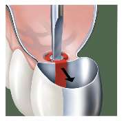 microtec / minodent Inh. M. Nolte - GALLERY