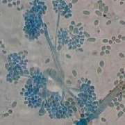 Grauschimmel, Botrytis sp.