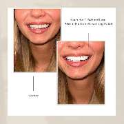 Natürlich Weiss by Asli - 4