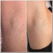 Nicoleta EpiArt Schönheitssalon - GALLERY