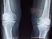 Orthopäde Dr. Michael Prange - GALLERY