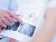 Orthopädie Zentrum Eppendorf - Hüftarthrose Broschüre