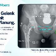 OrthoPlus Moers - GALLERY