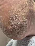 PodoAkitve Berlin - 10