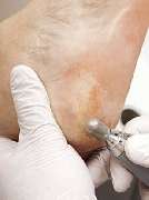 PodoAkitve Berlin - 12