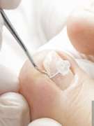 PodoAkitve Berlin - 16