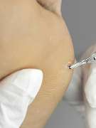 PodoAkitve Berlin - 17