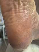 PodoAkitve Berlin - 21