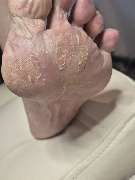 PodoAkitve Berlin - 22