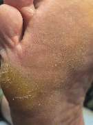 PodoAkitve Berlin - 8