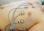 Praxis Dr. med. Thorsten Kleinschmidt Facharzt für Allgemeinmedizin - EKG