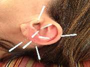 Praxis für Homöopathie & Ohrakupunktur Yvonne Liedke - 5