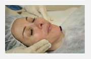 Praxis für med. Kosmetik | Diana Larisch | Kosmetik | Haarentfernung | Naturheilkunde | München - microneedling-2 | Praxis für med. Kosmetik | Diana Larisch |München