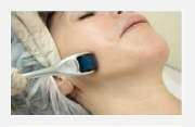 Praxis für med. Kosmetik | Diana Larisch | Kosmetik | Haarentfernung | Naturheilkunde | München - microneedling-4 | Praxis für med. Kosmetik | Diana Larisch |München