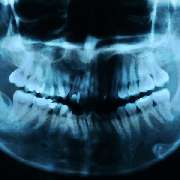 Praxis für Zahnheilkunde, Michael Meurer - 3