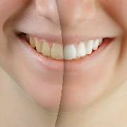 Praxis für Zahnheilkunde, Michael Meurer - 4