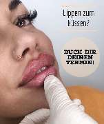 PrettyDoc Düsseldorf - Hyaluron und Botox Düsseldorf - GALLERY