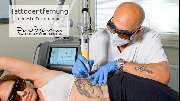 Proderma Hautzentrum in Bad Homburg GmbH - Tattooentfernung neueste Technologie