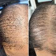 Raasant UG (haftungsbeschränkt) - GALLERY