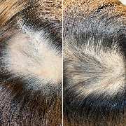 Raasant UG (haftungsbeschränkt) - GALLERY