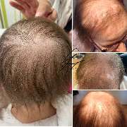 Raasant UG (haftungsbeschränkt) - GALLERY