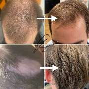 Raasant UG (haftungsbeschränkt) - GALLERY