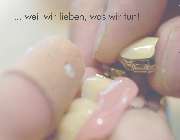 schenk zahntechnik - GALLERY