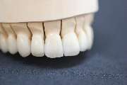 Schmidt Dental EK - GALLERY