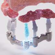 Semlinger Industry GmbH - GALLERY