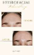 Skintastic Julia Riemer - 11