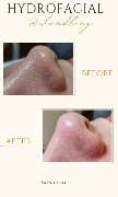 Skintastic Julia Riemer - 12