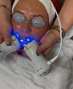 Solavie - Blauer Laser 1.jpeg