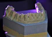 Thomas Dental GmbH Zahntechnik Köln - Thomas Dental GmbH