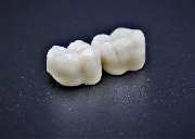 Thomas Dental GmbH Zahntechnik Köln - Thomas Dental GmbH