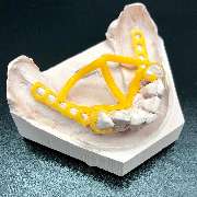 Thomas Dental GmbH Zahntechnik Köln - Thomas Dental GmbH Dentallabor