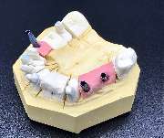 Thomas Dental GmbH Zahntechnik Köln - Thomas Dental GmbH Dentallabor