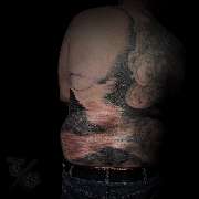 Totally Skin - GALLERY
